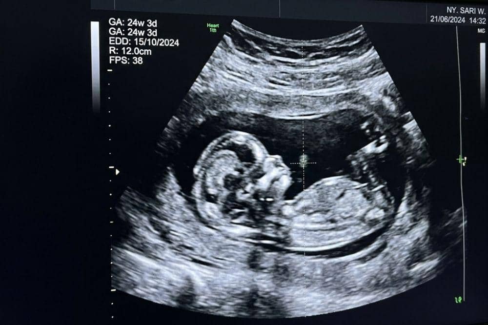 Popmama.com/Alya Putri Abi/AI