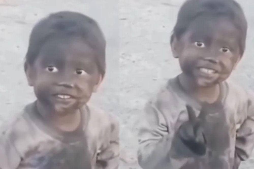 Perjuangan Azil di Balik Wajah Cemong yang Viral, Bikin Haru