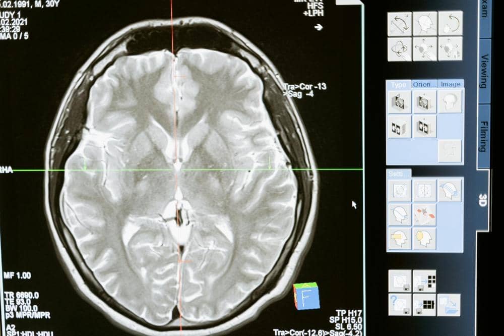 Perkembangan otak anak