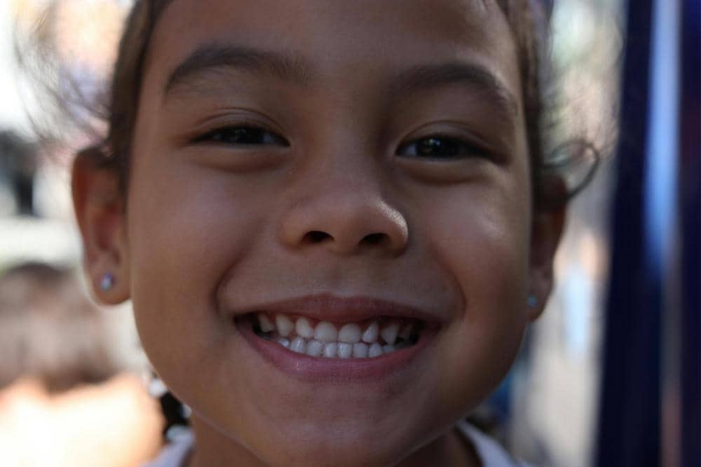 Bukan Permen, Ini Penyebab Gigi Bolong pada Anak 3 Tahun