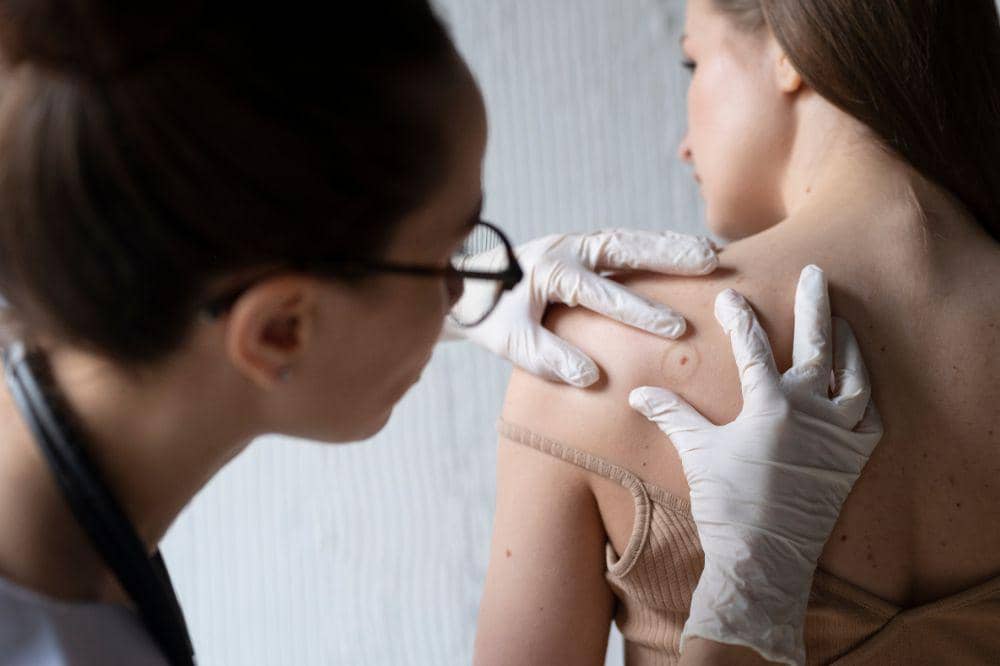 Benarkah Penyakit Kronis Bisa Memicu Cacar Api?