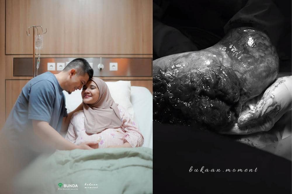 Zaskia Sungkar Lahirkan Baby Urwah secara En Caul, Apa Artinya?