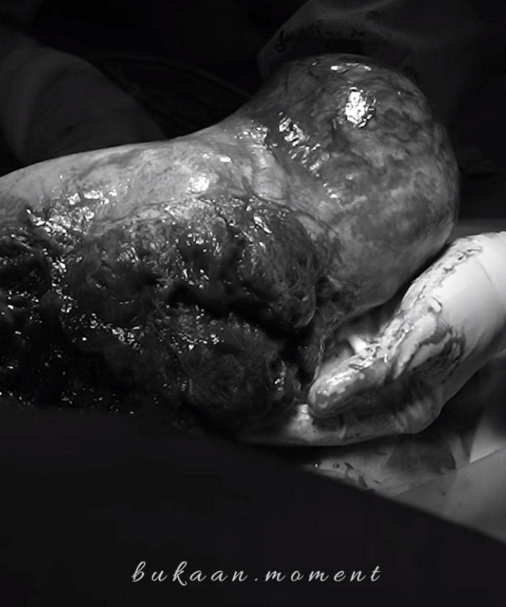 Langka! Zaskia Sungkar Lahirkan Baby Urwah secara En Caul, Apa Artinya? 3.jpg