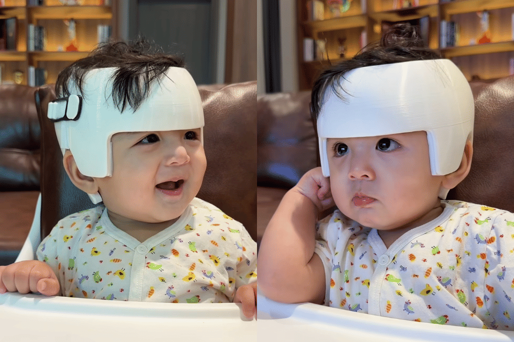 Perbaiki Bentuk Kepala, Ini 7 Foto Anak Erika Carlina Pakai Helm Orthopaedia