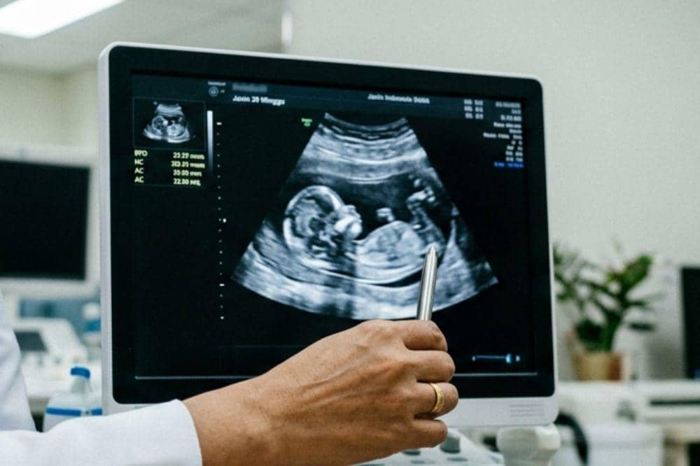 Popmama.com/Alya Putri Abi/AI