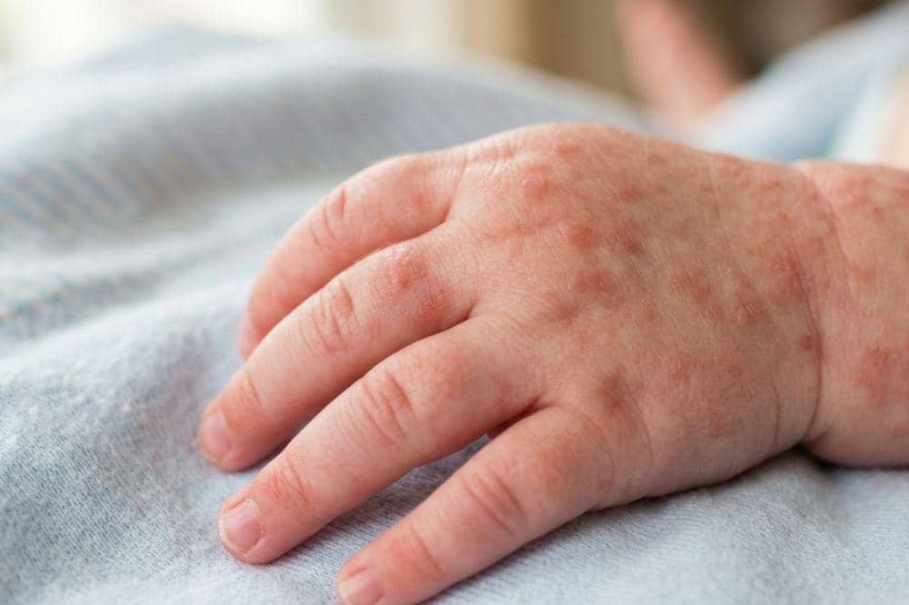Kenapa Bayi Muntah setelah Minum Susu Formula 3