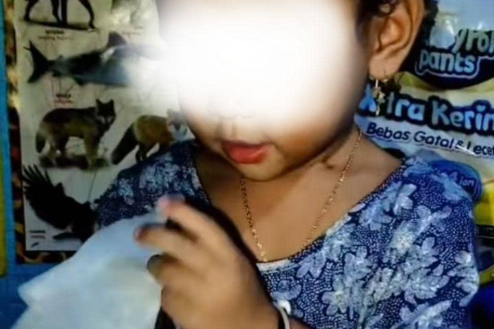 Arumi Korban Malpraktik Berujung Amputasi, Kini Cari Mana Tangannya