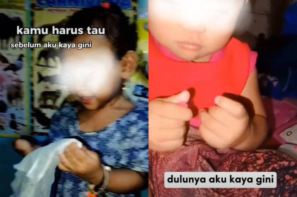 arumi korban amputasi karena malpraktik (1).jpg