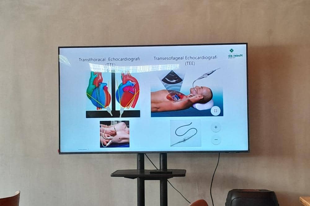Pemaparan materi Penyakit Jantung Bawaan (PJB) oleh dr. Yovi Kurniawati, Sp. J. P. Subsp. K. Ped. P. J. B. (K)