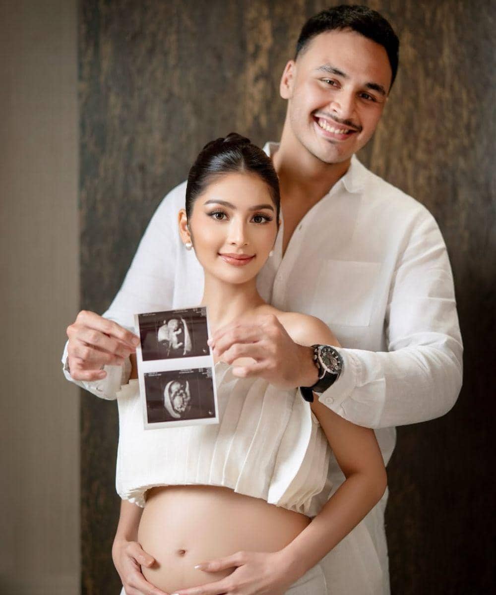 Debi Sagita Umumkan Kehamilan Anak Pertamanya bersama Marco Ivanos (2)