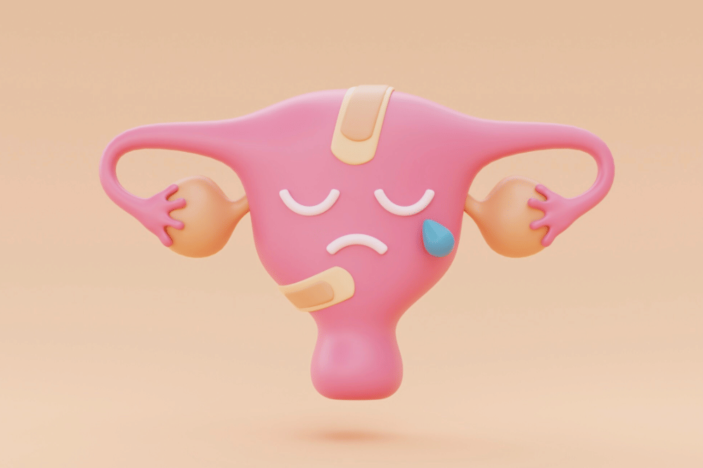 PCOS PMOS (6).png