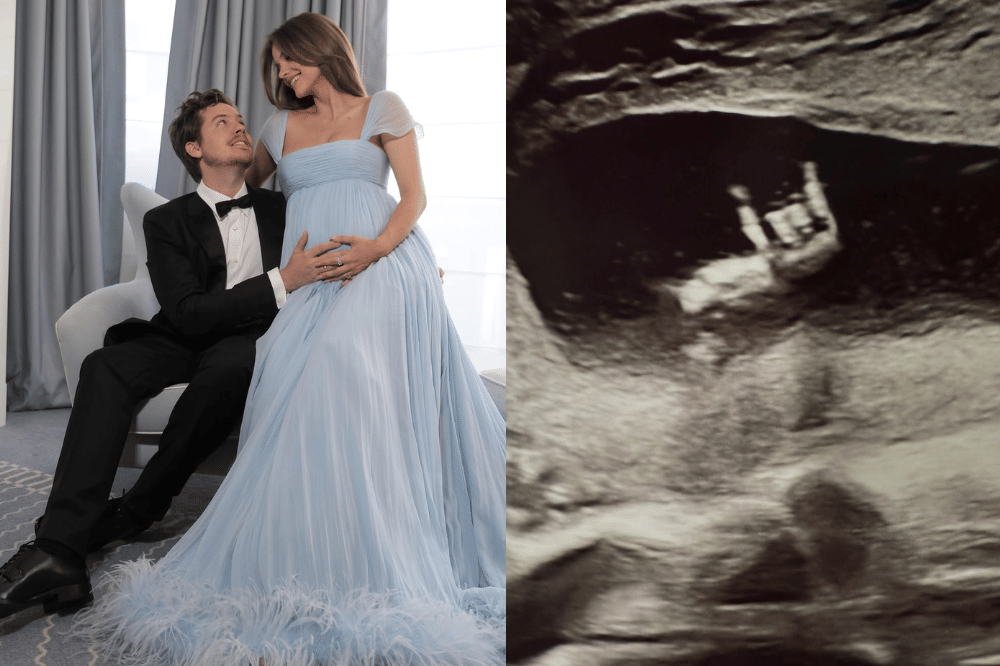 Barbara Palvin Istri Dylan Sprouse Umumkan Hamil Anak Pertama 2.png