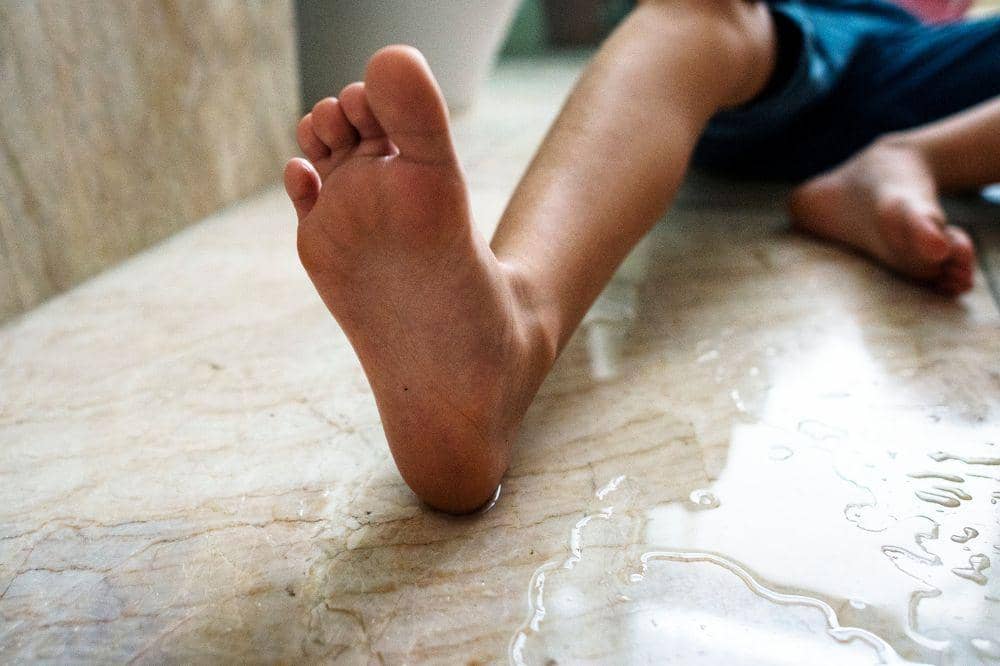 ilustrasi kaki cedera.jpg
