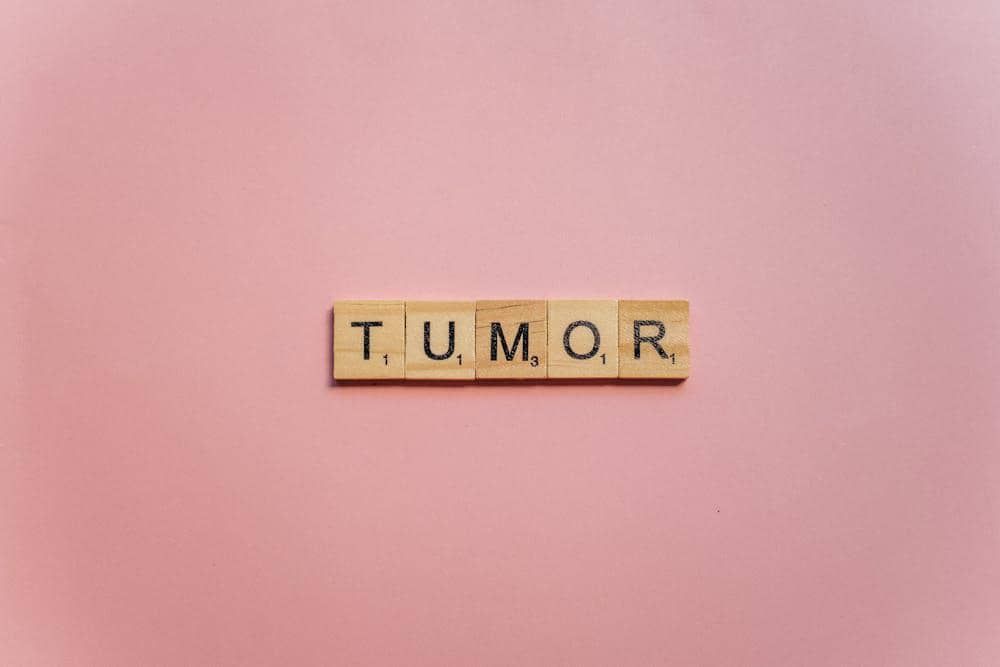 ilustrasi tumor