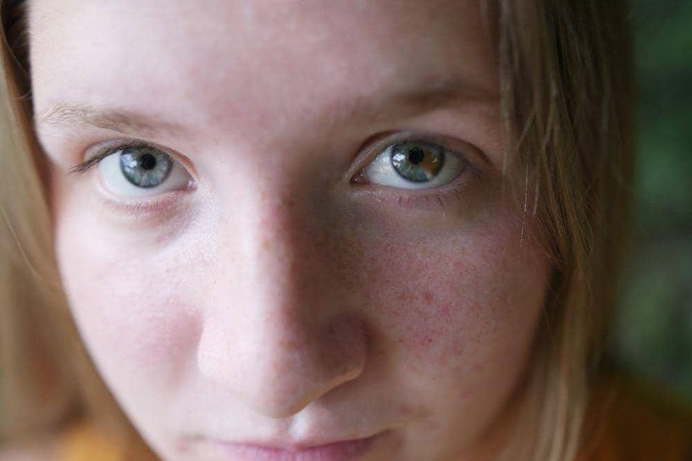 Apa Itu Mata Heterochromia_ 3.jpg