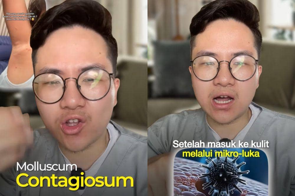 molluscum contagiosum.jpg