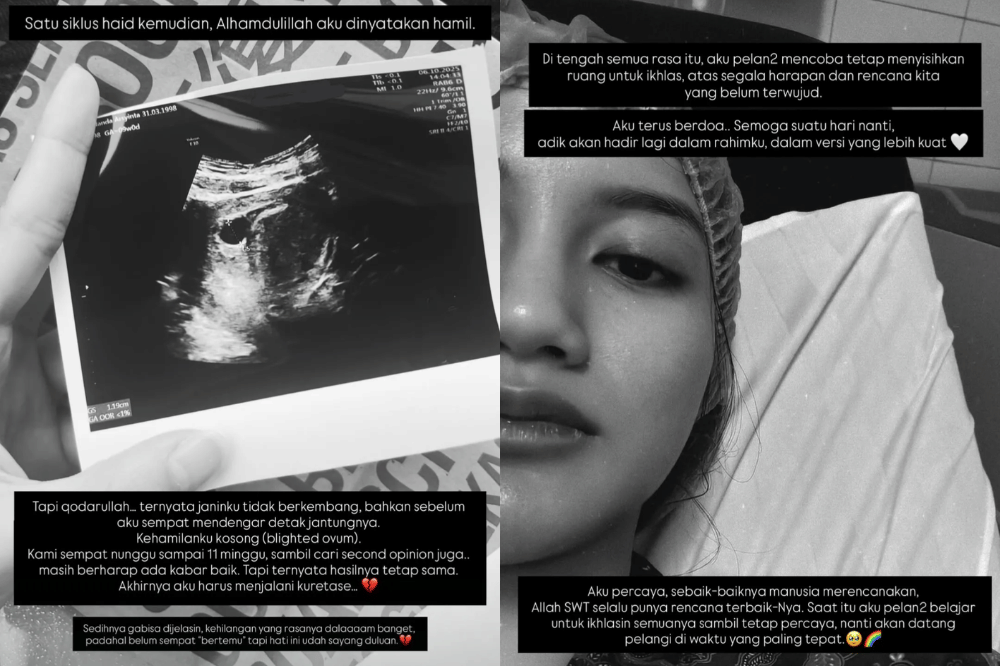 Bahagianya Nanda Arsyinta Hamil Anak Kembar Laki-Laki dan Perempuan 2.png
