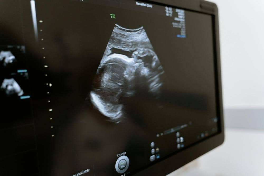 HPL Berubah-ubah saat Hamil, Apa yang Salah? Ini Kata Dokter