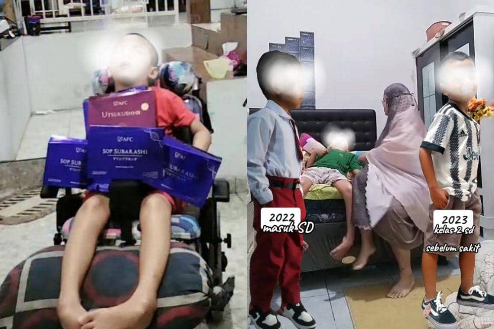 Kisah Pilu Anak Usia 9 Tahun Alami Kelumpuhan Otak Usai Terjatuh Dua Kali