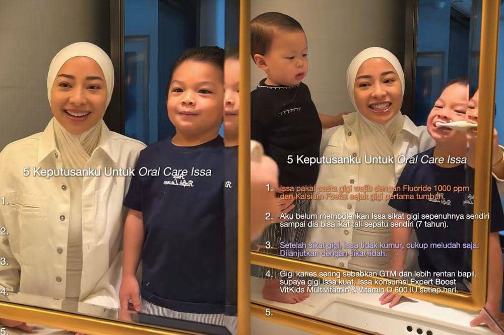 5 Langkah Jaga Kesehatan Gigi Anak ala Issa, Cegah Karies Sejak Dini