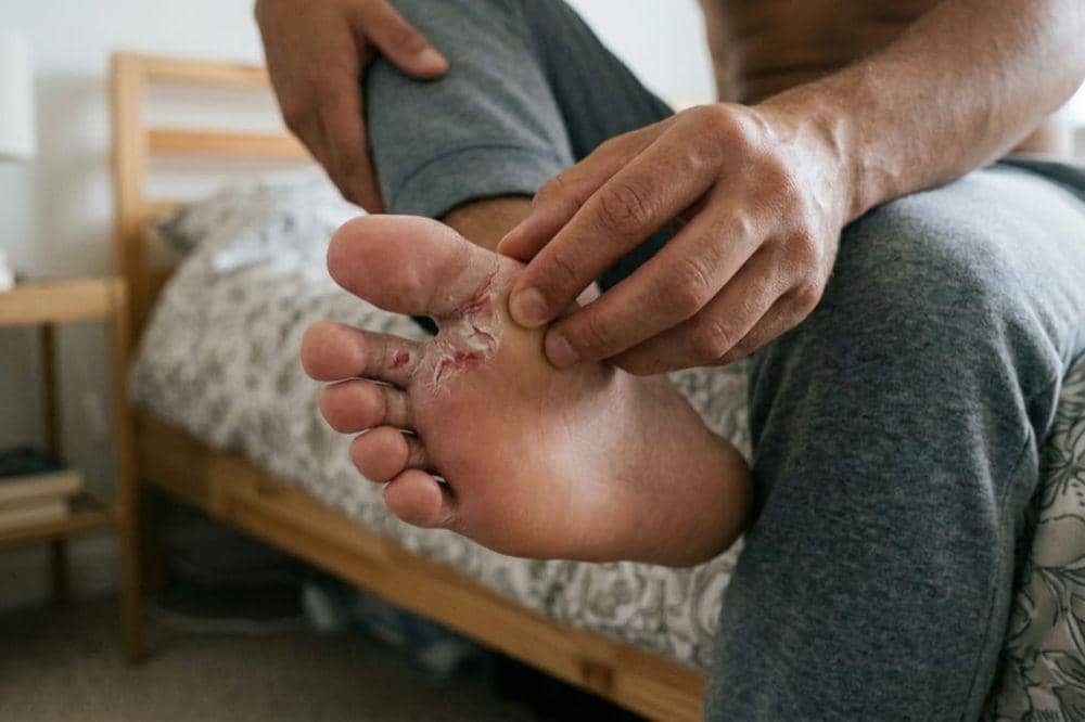 Penyebab Gatal di Sela Jari Kaki 2.jpg