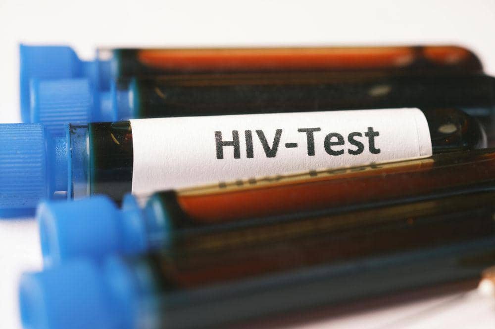 Sebanyak 10.533 anak di Indonesia hingga Juni 2025 menderita HIV/AIDS