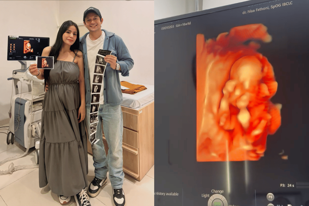 Kabar Bahagia, Violentina Kaif Hamil Anak Pertama dengan Andrew Andika