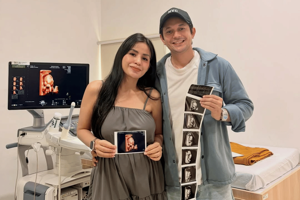 Andrew Andika umumkan istri hamil anak pertama