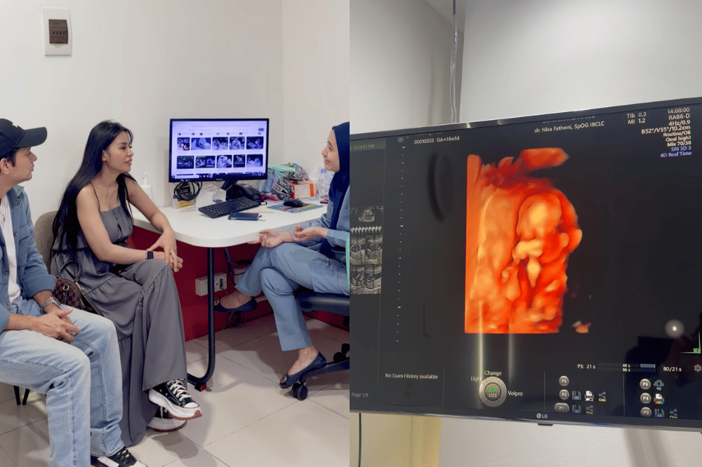 Andrew Andika umumkan istri hamil anak pertama