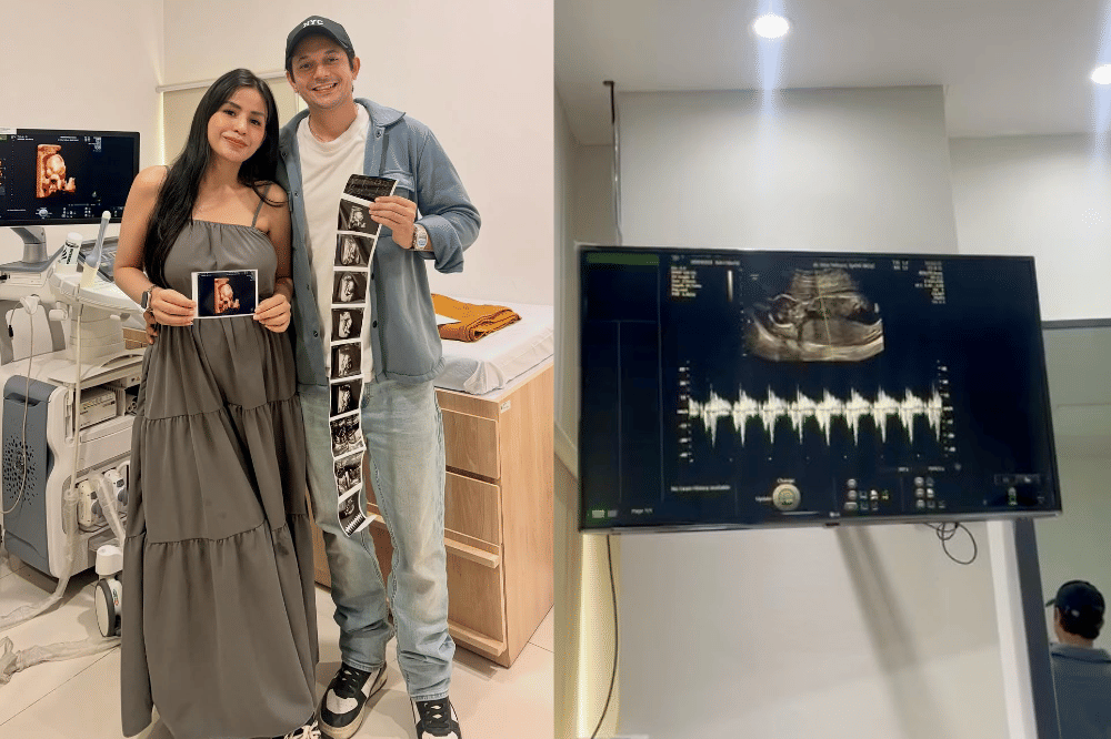 5 Fakta Kehamilan Violentina Kaif Istri Andrew Andika