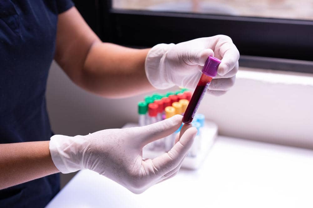 Perbedaan LH Test dan Test Pack