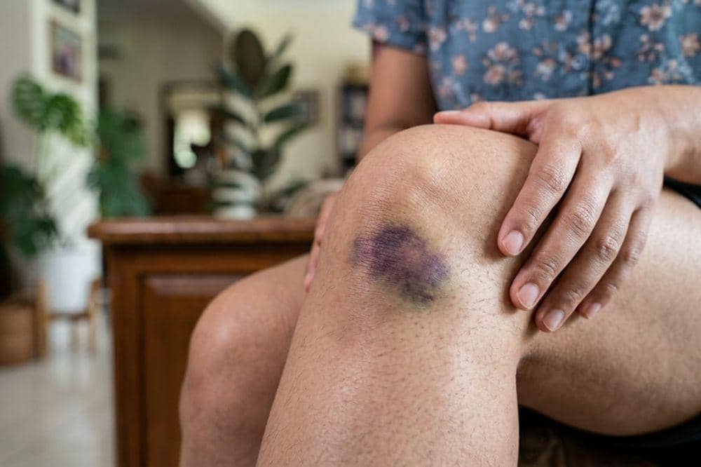 Gejala Sakit Liver yang Sering Tidak Disadari Banyak Orang 6