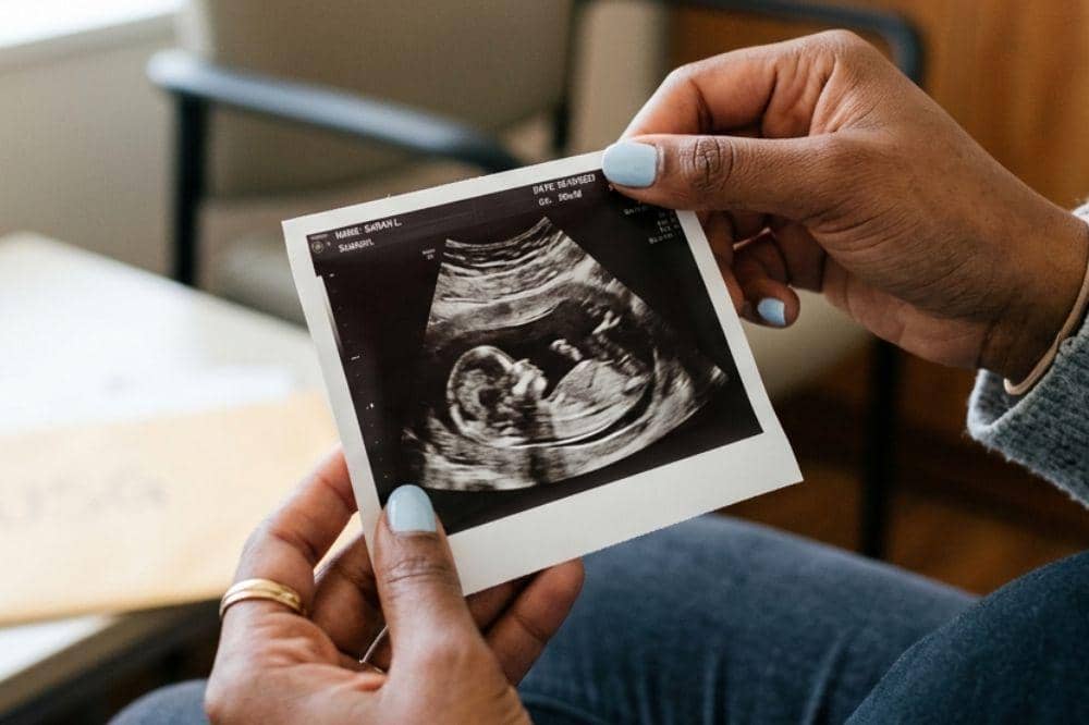 Tidur telentang dikaitkan dengan peningkatan risiko stillbirth