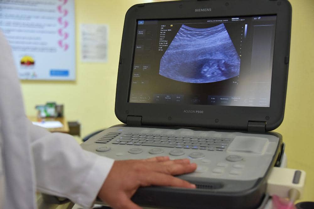 Tips agar ibu hamil bisa melahirkan normal