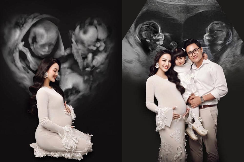 7 Foto Maternity Nanda Arsyinta dengan Latar Hasil USG, Hamil Kembar!
