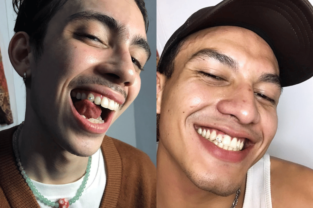 Perhiasan Gigi (6).png