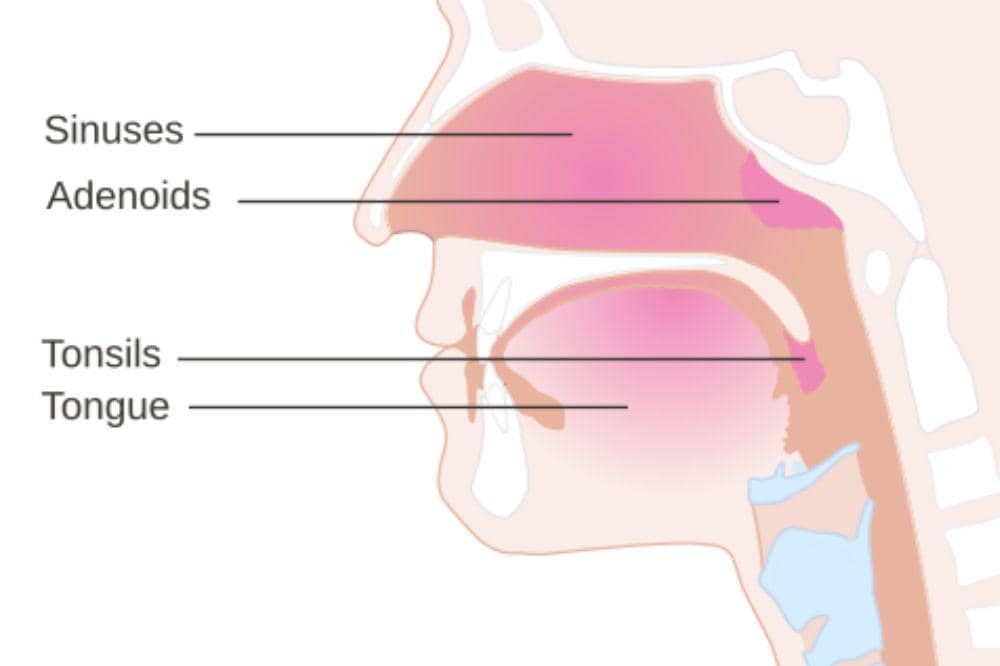 adenoid pada anak