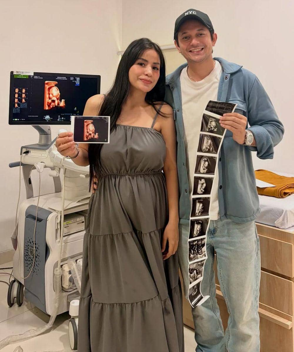 Andrew Andika Ingin Vasektomi Jika Dikaruniai Anak Laki-Laki dari Vio (1).jpg