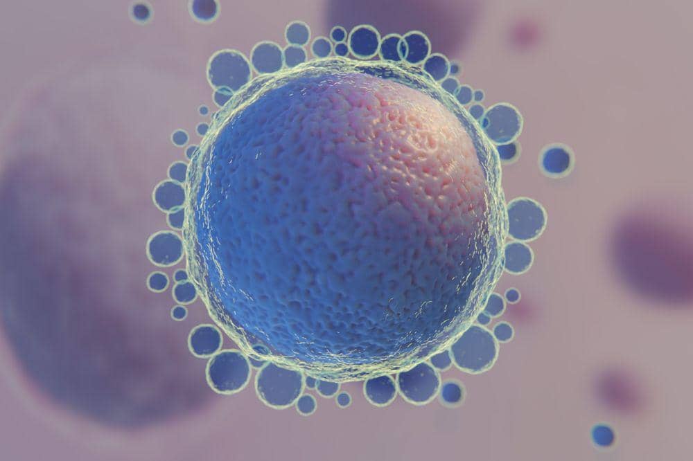 1. Azoospermia (Tidak Ada Sel Sperma dalam Cairan Semen).jpg