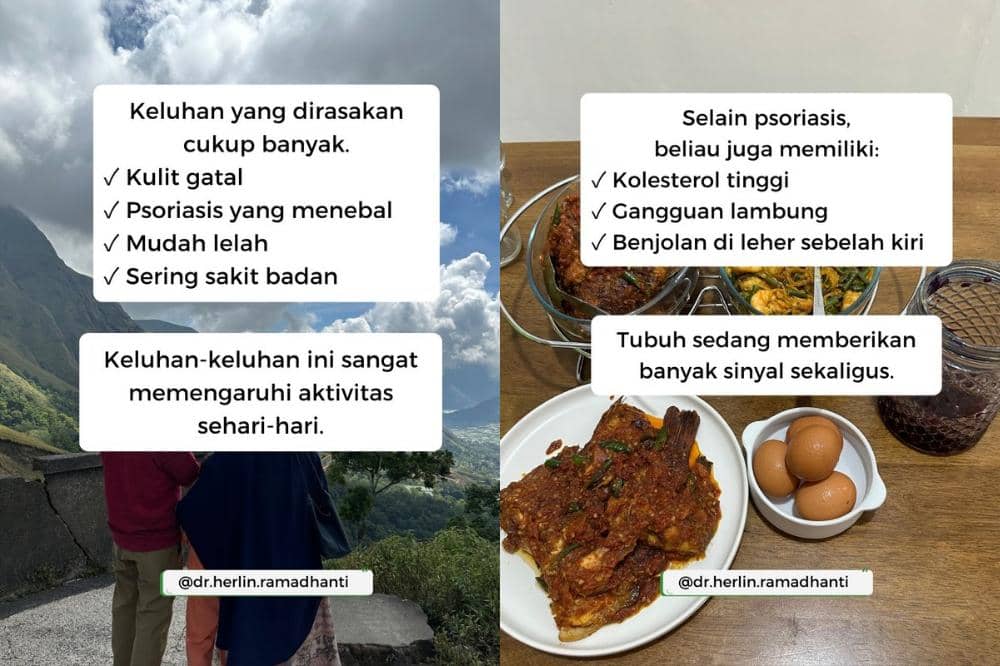 Psoriosis bukan masalah kulit biasa