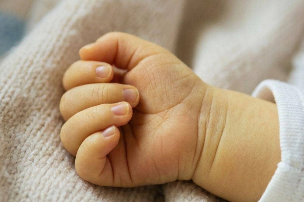 Ciri bayi kuning yang masih tergolong normal