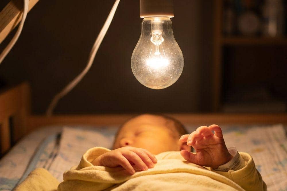 Apakah bayi kuning boleh disinari lampu di rumah?