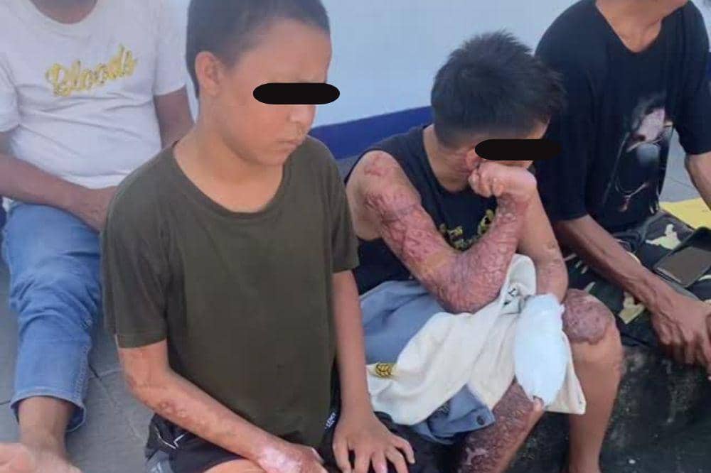 Santri di Lombok Diduga Dibakar Senior, Konon Kerap Dibully