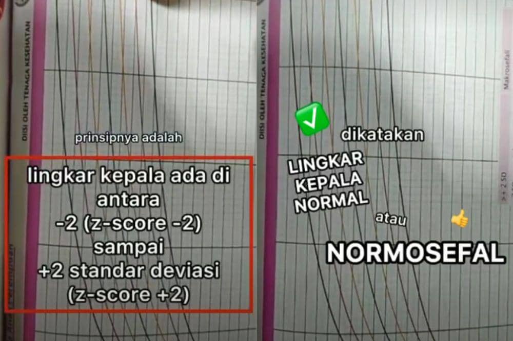 Kepala anak normal atau tidak
