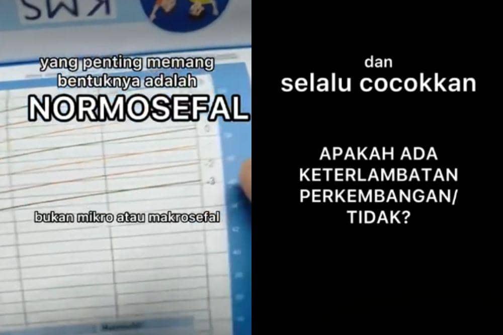 Kepala anak normal atau tidak