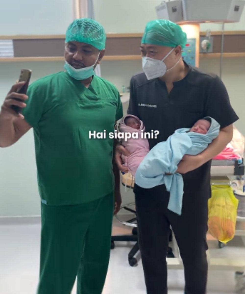 bayi kembar sumenep