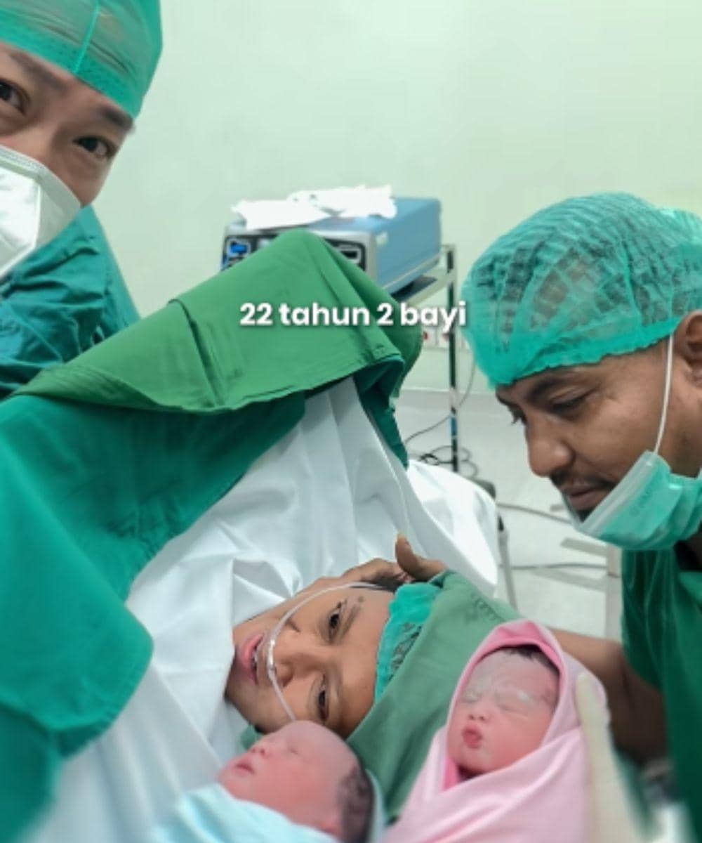 bayi kembar sumenep