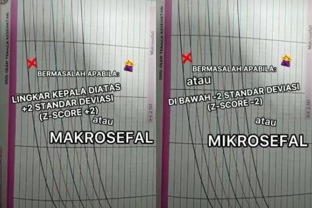 Kepala anak normal atau tidak
