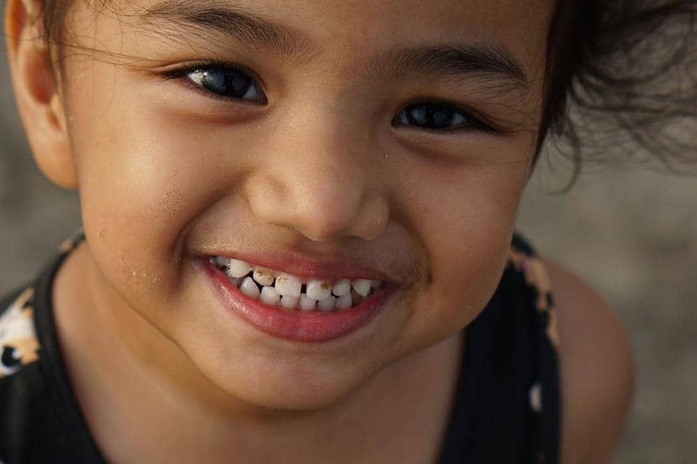 Senyuman anak ini menunjukkan bahwa gigi susunya ada plak