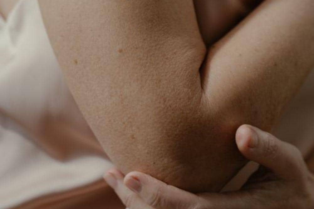 Apakah Autoimun Menular? Ini Fakta yang Wajib Kamu Tahu
